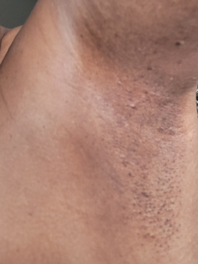 Turmeric Sugar Scrub