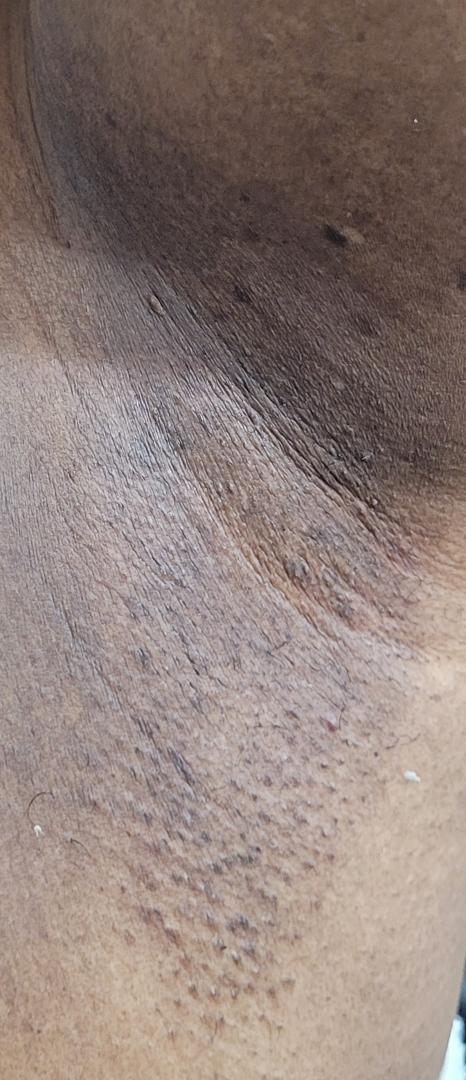 Turmeric Sugar Scrub